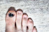 Preventing Toenail Issues While Running