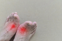 Symptoms and Triggers of Gout Attacks