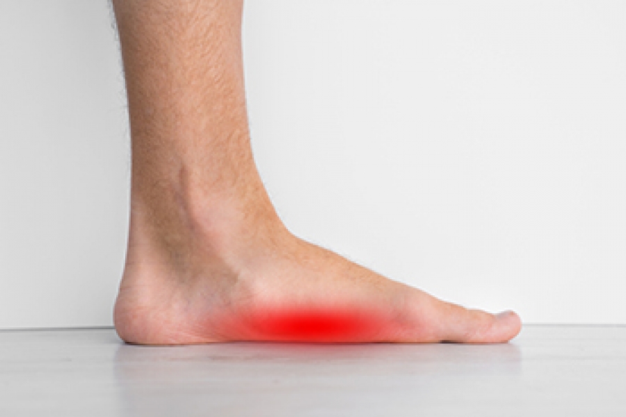 Symptoms and Causes of Flat Feet