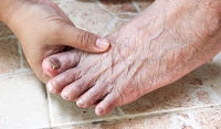 Symptoms and Treatment of Fungal Toenails